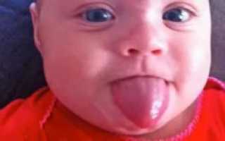 У ребенка язык не помещается во рту