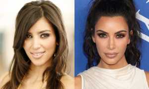 Бьюти-эволюция семейства Кардашьян: на какие операции решились звезды реалити-шоу