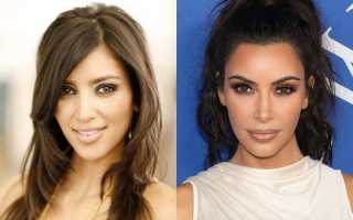 Бьюти-эволюция семейства Кардашьян: на какие операции решились звезды реалити-шоу