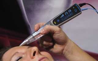 Плазменное омоложение лица косметологическими аппаратами — как выбрать лучший