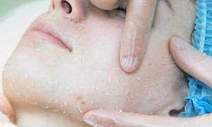 Пилинг-скатка от Tony Moly — в чем секрет популярности средства