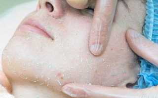 Пилинг-скатка от Tony Moly — в чем секрет популярности средства