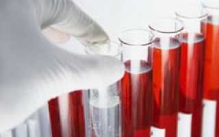 Анализ крови на туберкулез