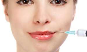 Что такое биоревитализация губ, можно ли с ее помощью сделать их больше