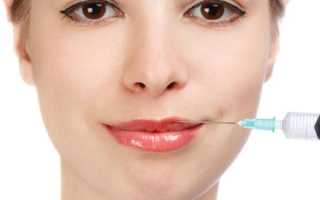 Что такое биоревитализация губ, можно ли с ее помощью сделать их больше