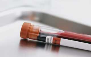 Значение связывающего мужские половые гормоны глобулинового белка