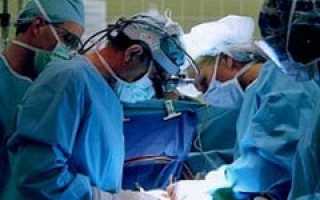 Киста позвоночника