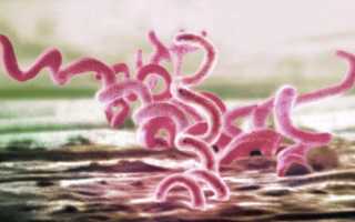 Спинная сухотка — 12 симптомов и профилактика. Чем опасна для спинного мозга?