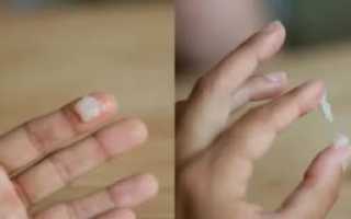 Водянистые выделения