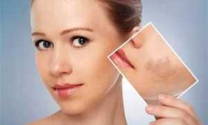 Лосьон-пилинг: для какой кожи подойдет, ТОП-5 лучших