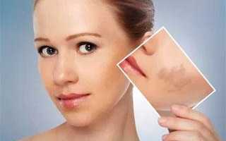 Лосьон-пилинг: для какой кожи подойдет, ТОП-5 лучших