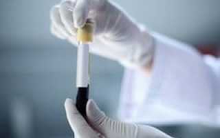 Анализ крови на ТТГ