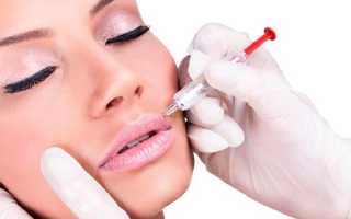 Увеличение губ гиалуроновой кислотой — особенности процедуры о которых важно знать