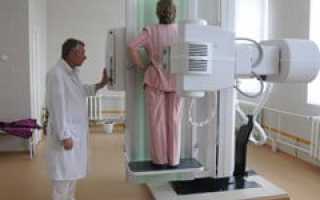 Флюорография легких