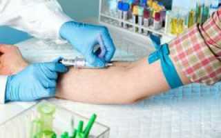 RDW в анализе крови