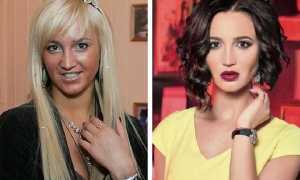 Известные инстаграмщицы и их пластика: как перекроили себя российские инста-дивы