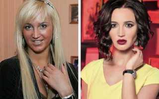 Известные инстаграмщицы и их пластика: как перекроили себя российские инста-дивы