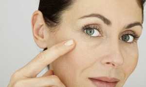 Коррекция носослезной борозды филлерами: что нужно знать перед походом к косметологу