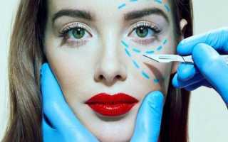 Круговая блефаропластика — можно ли выглядеть на 10 лет моложе после одной операции