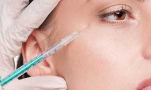 Чем опасен ботокс и какие могут быть последствия после процедуры