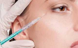 Чем опасен ботокс и какие могут быть последствия после процедуры