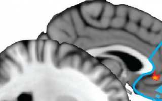 Глава 7. Невнимание и импульсивность. Префронтальная кора