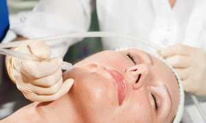 Кислородный пилинг — щадящий способ вернуть коже молодость и красоту