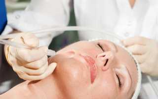 Кислородный пилинг — щадящий способ вернуть коже молодость и красоту