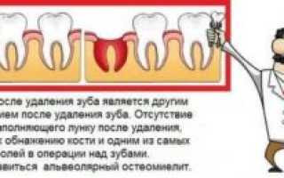 Выпадает губка после удаления зуба