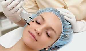 Лазерная чистка лица: особенности процедуры и ее эффективность