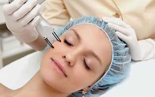 Лазерная чистка лица: особенности процедуры и ее эффективность