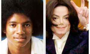 Знаменитые мужчины, которые не на шутку увлеклись пластическими операциями