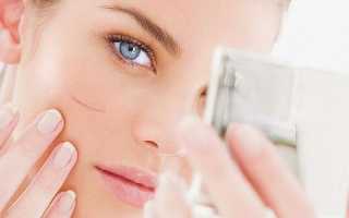 Шлифовка рубцов: как выполняется, в каком случае можно добиться заметного эффекта