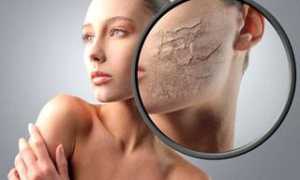 Пилинг для сухой и нормальной кожи лица: для чего нужен, какие средства для этого подойдут