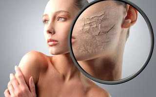 Пилинг для сухой и нормальной кожи лица: для чего нужен, какие средства для этого подойдут