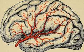 Сосудистый генез головного мозга: что это такое и как его лечить