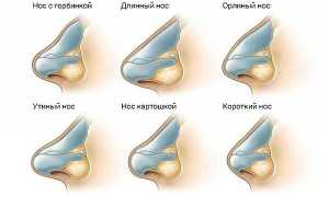 39 знаменитых людей до и после ринопластики — раскрываем все секреты