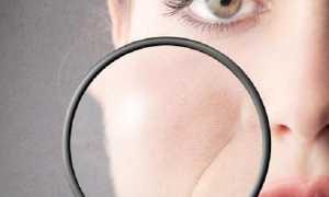 Лазерная биоревитализация — новая методика омоложения с особенностями, о которых нужно знать заранее