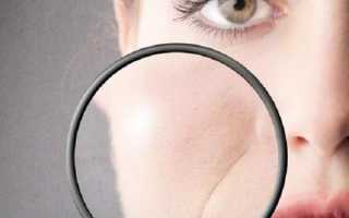 Лазерная биоревитализация — новая методика омоложения с особенностями, о которых нужно знать заранее