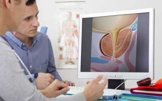 Осложнение мочекаменной болезни