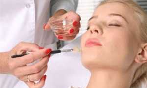 Что такое АБР пилинг и кому он лучше всего подходит, мнения косметологов