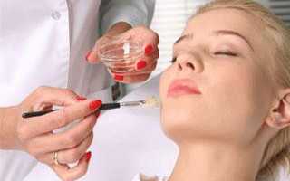 Что такое АБР пилинг и кому он лучше всего подходит, мнения косметологов