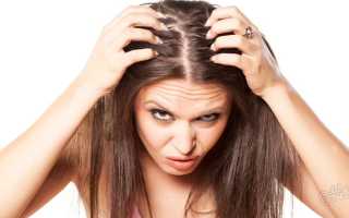 Перхоть — причины и лечение