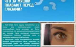 Мушки в глазах после операции