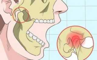 После удара в голову болит челюсть