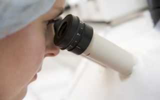 Основные правила при подготовке к спермограмме