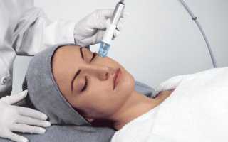 Вакуумная чистка лица дома и в салоне: как проходит процедура