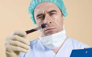 Анализ на онкологию простаты