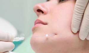 Нити Спринг Трейд — омоложение, не имеющее возрастных границ