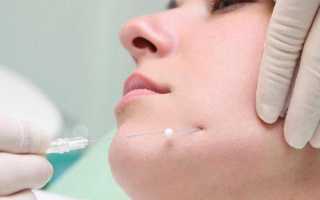 Нити Спринг Трейд — омоложение, не имеющее возрастных границ